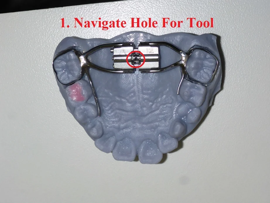 Expander Instructions Step 2