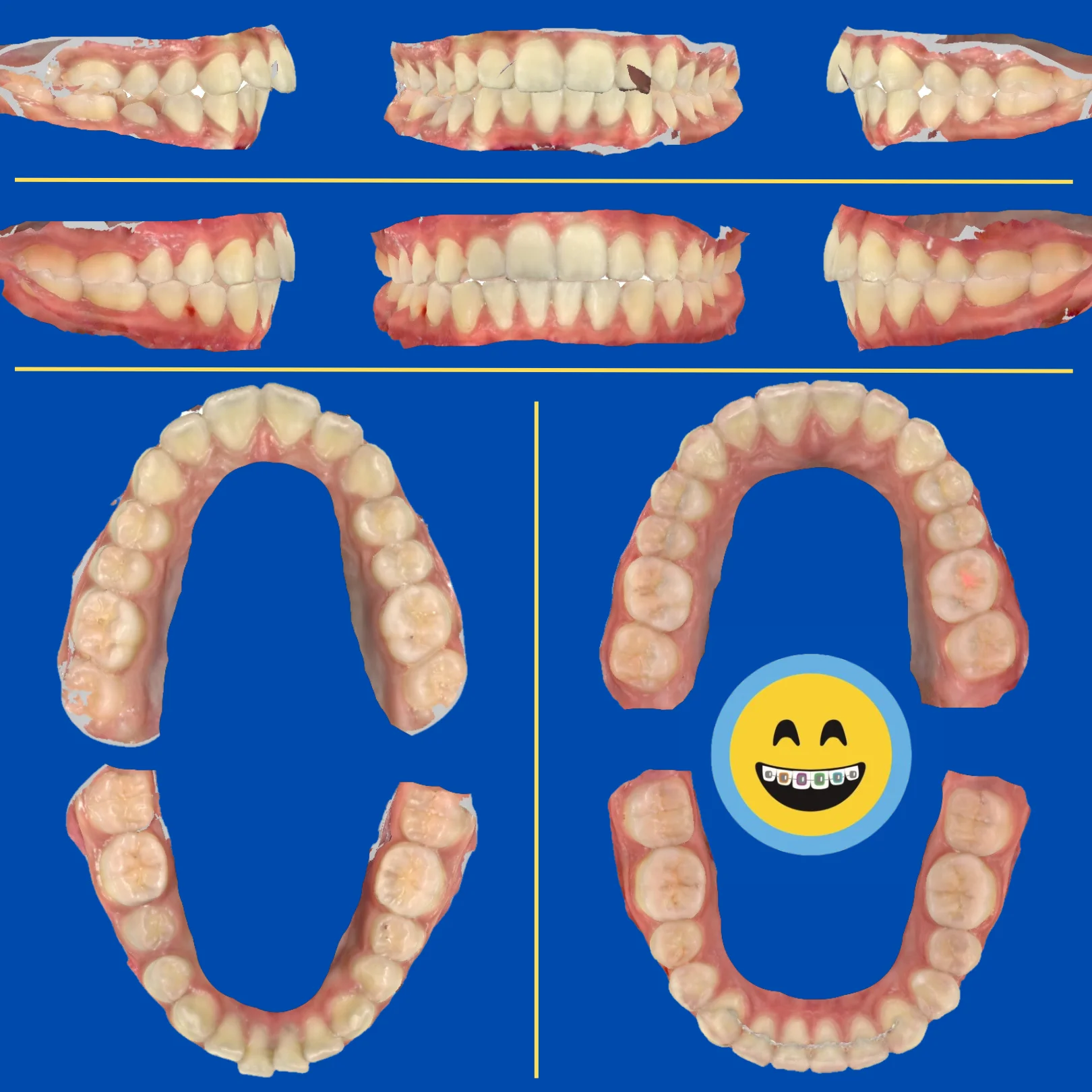 Rahim - Before and After