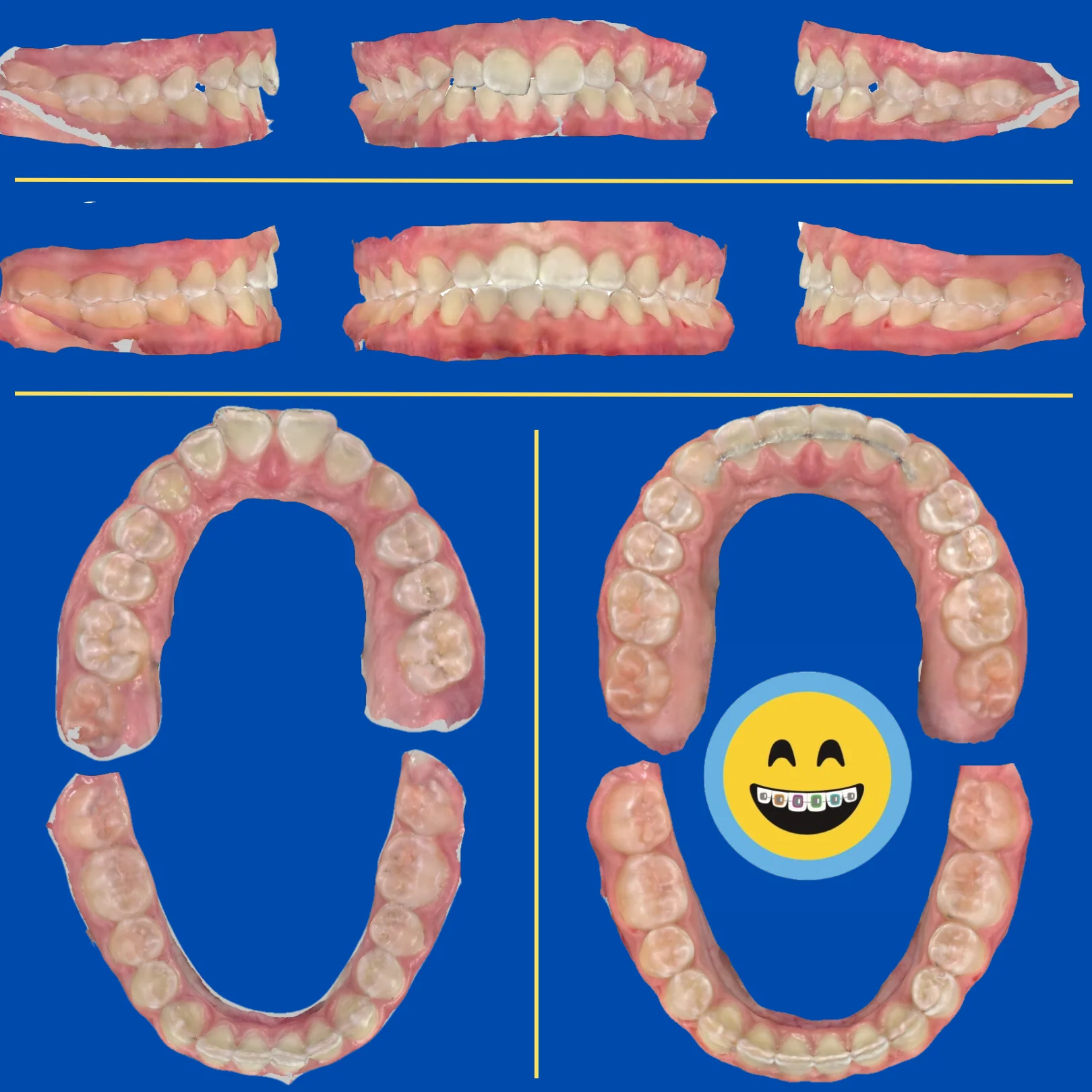 Amy - Before and After